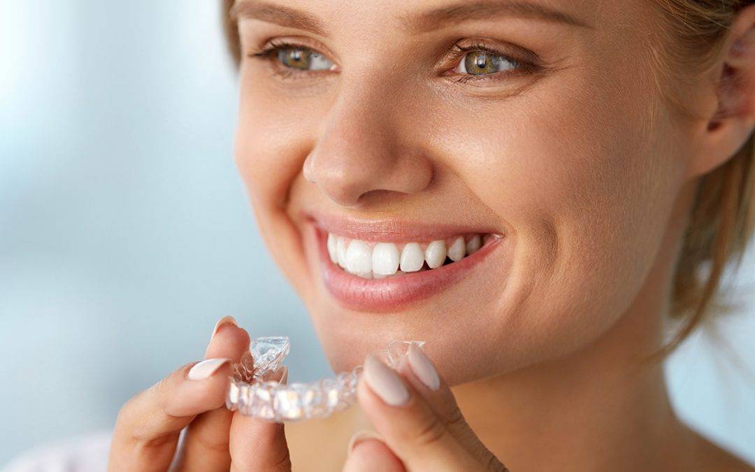 Apparecchi dentali invisibili